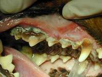 Zahnstein und Parodontitis